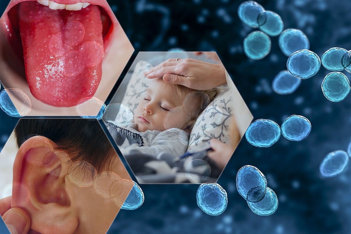 What is Strep-A and how can you prevent an outbreak?